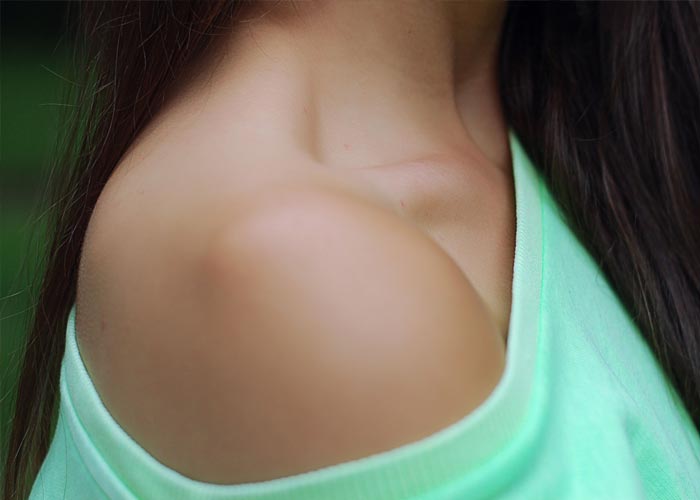 Cool Weather Eczema and Dry Skin Tips